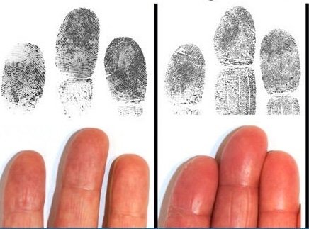 Sidik Jari Untuk Mendeteksi Pecandu Narkoba