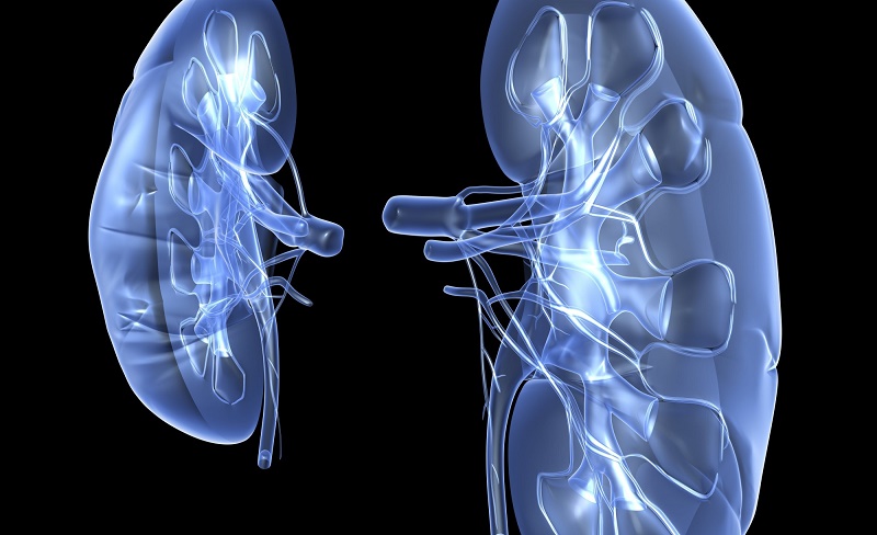 Yuk Intip! Cara Mudah dan Murah ‘Cuci’ Ginjal