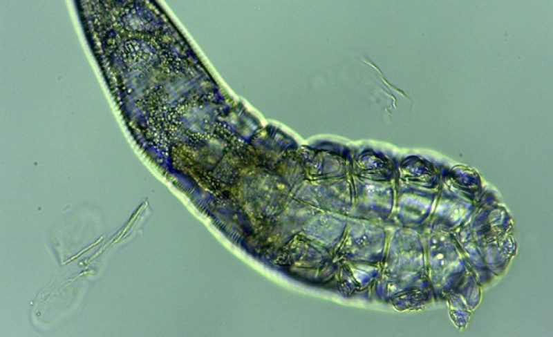 Ternyata Ada ‘Ulat’ Berkaki 8 Di Wajah Semua Manusia?!