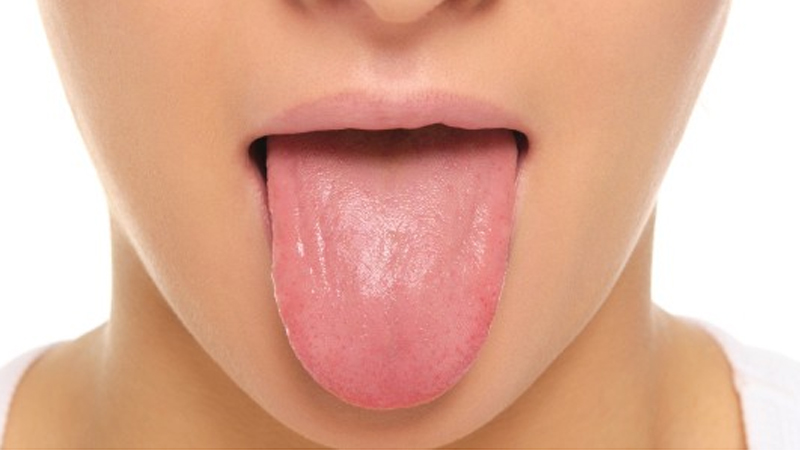 Pengecap Rasa Terbaru di Lidah Untuk ‘Deteksi’ Obesitas?