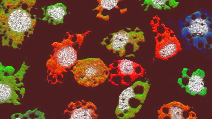 Virus Aneh Ini Telah Mendobrak dan Menemukan Cara Infeksi Terbaru