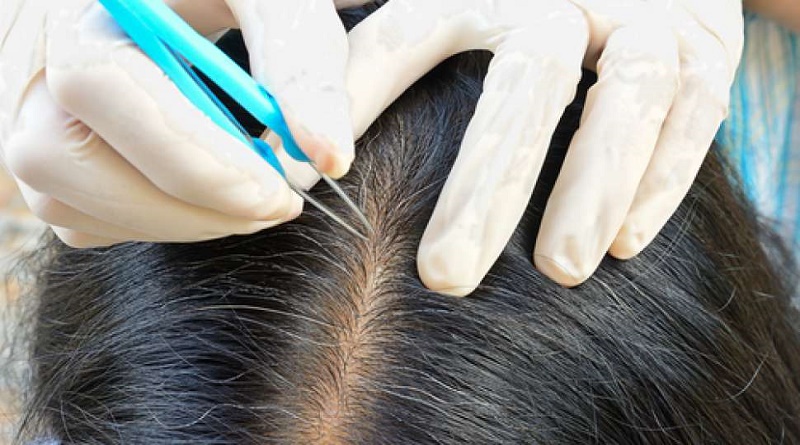 Ubanan di Usia 20-an? 4 Faktor Ini Penyebabnya!