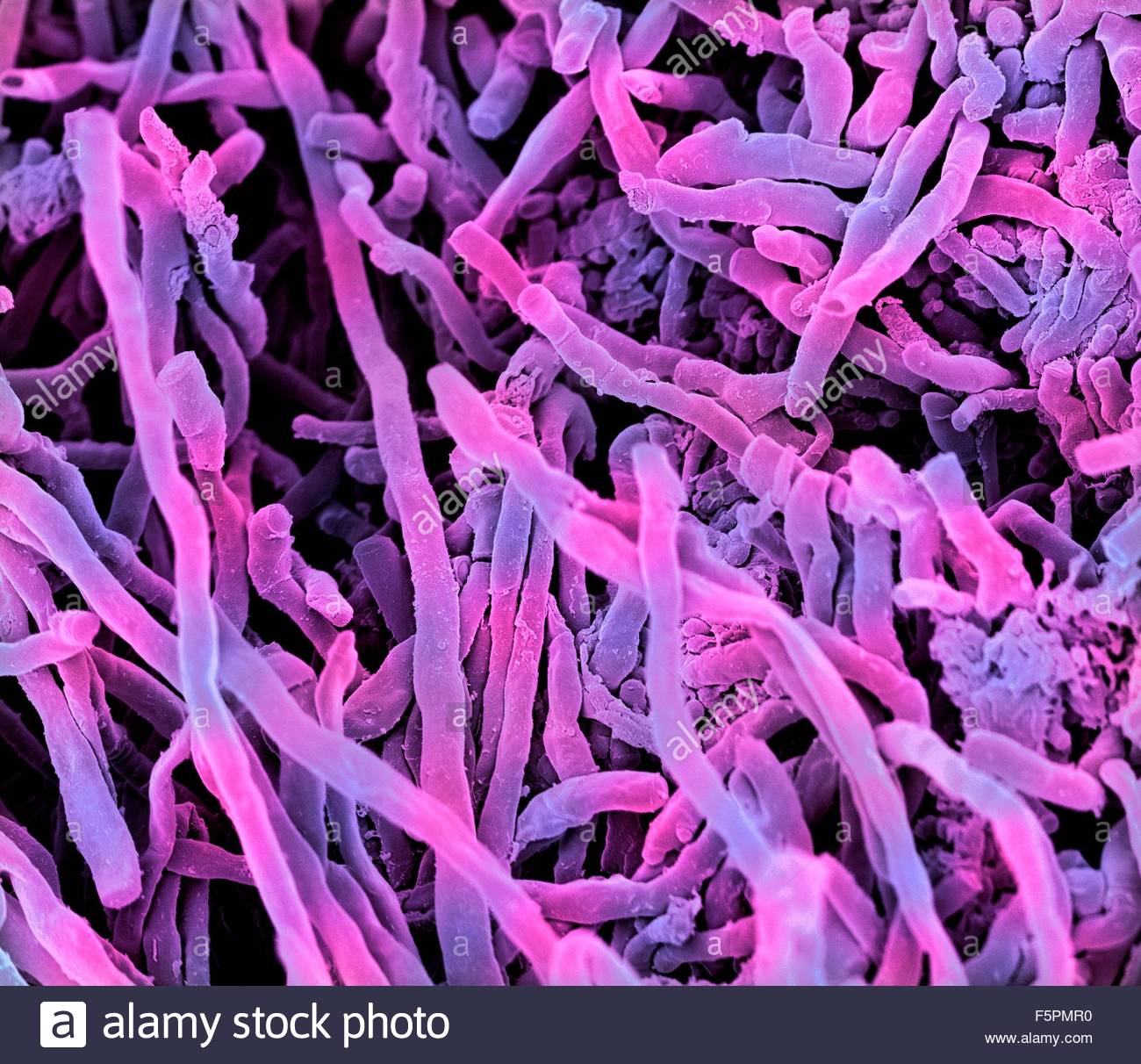 Streptomyces : Bakteri Mirip Fungi Penghasil Aroma Khas Tanah