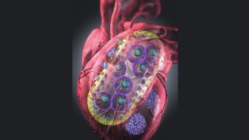 Teknologi Nanogel Memberikan Harapan bagi Penderita Penyakit Jantung