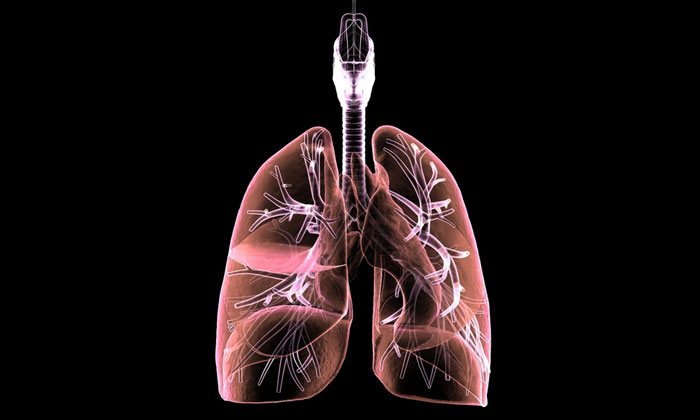 Inovasi Pengobatan Kanker Paru Pertama di Indonesia