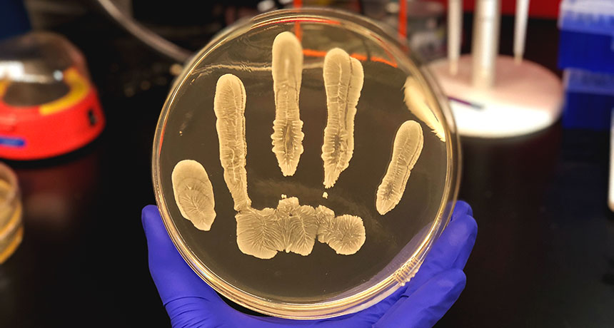 Bakteri Pada Kulit Manusia Dapat Digunakan untuk Melawan Kanker