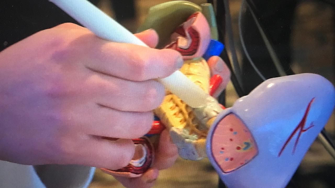 Interstitium : Organ Baru yang Memberikan Petunjuk Penyebaran Kanker