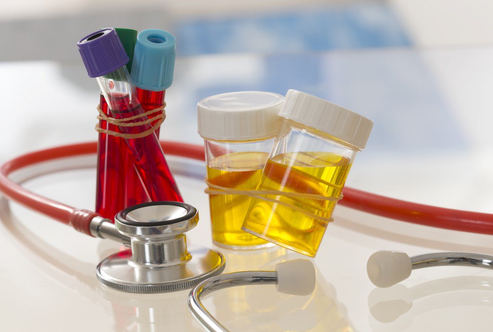 Peneliti Jepang Menggunakan Sampel Urin untuk Deteksi Kanker