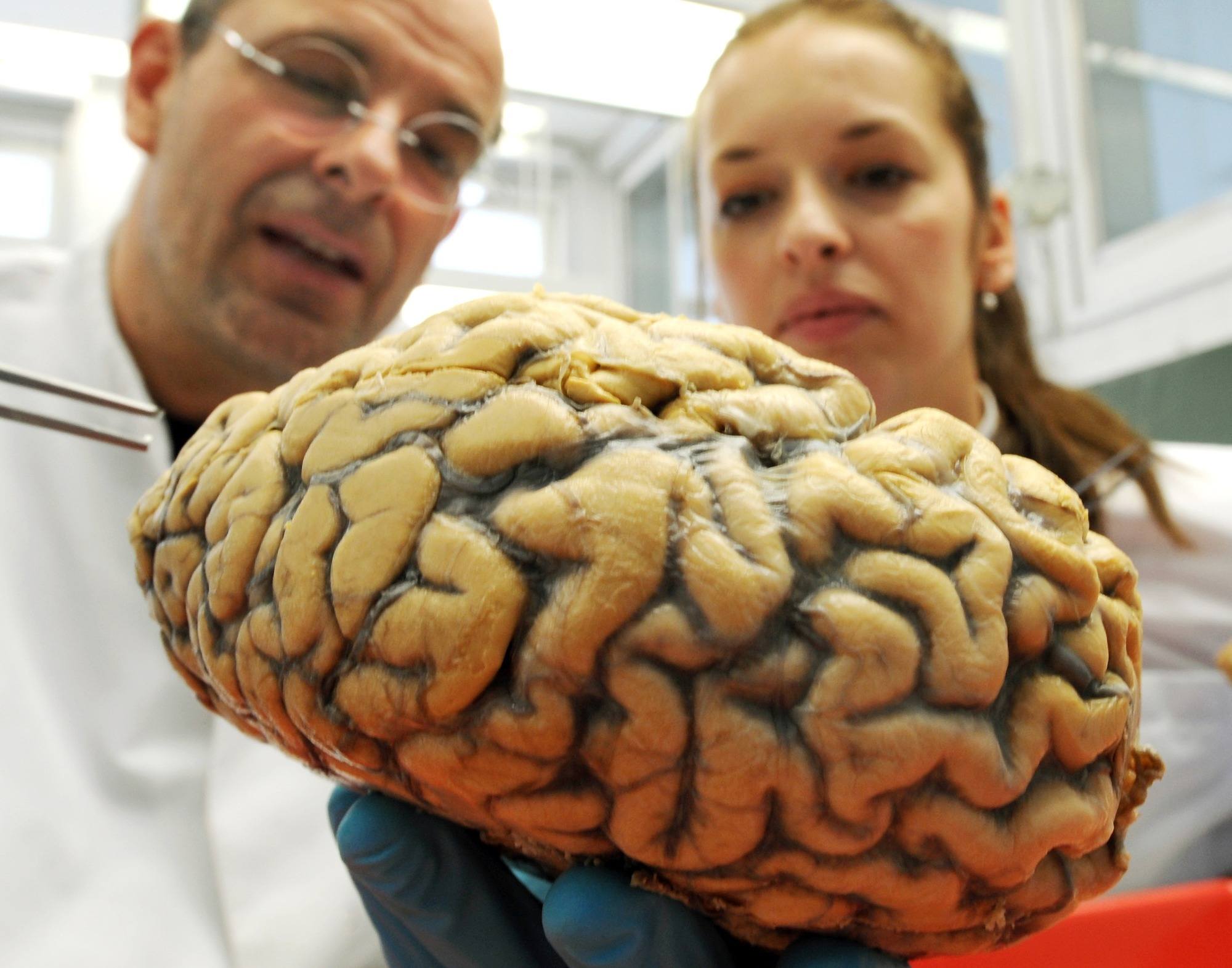 Seorang Ilmuwan Berhasil Membuat Otak Babi Tetap Berfungsi di Luar Tubuh