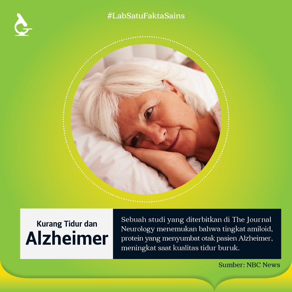 Kurang Tidur Tingkatkan Risiko Terkena Alzheimer
