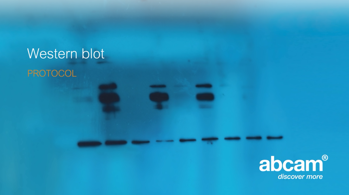 Western blot protocol video – Abcam