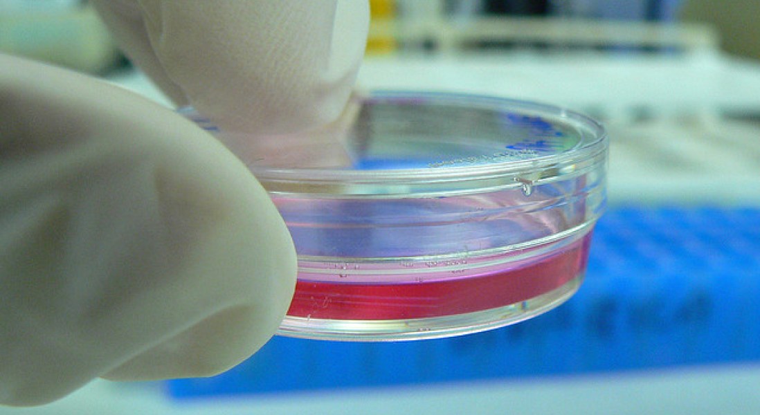 Peneliti Jepang Tumbuhkan Sel Telur Manusia di Laboratorium