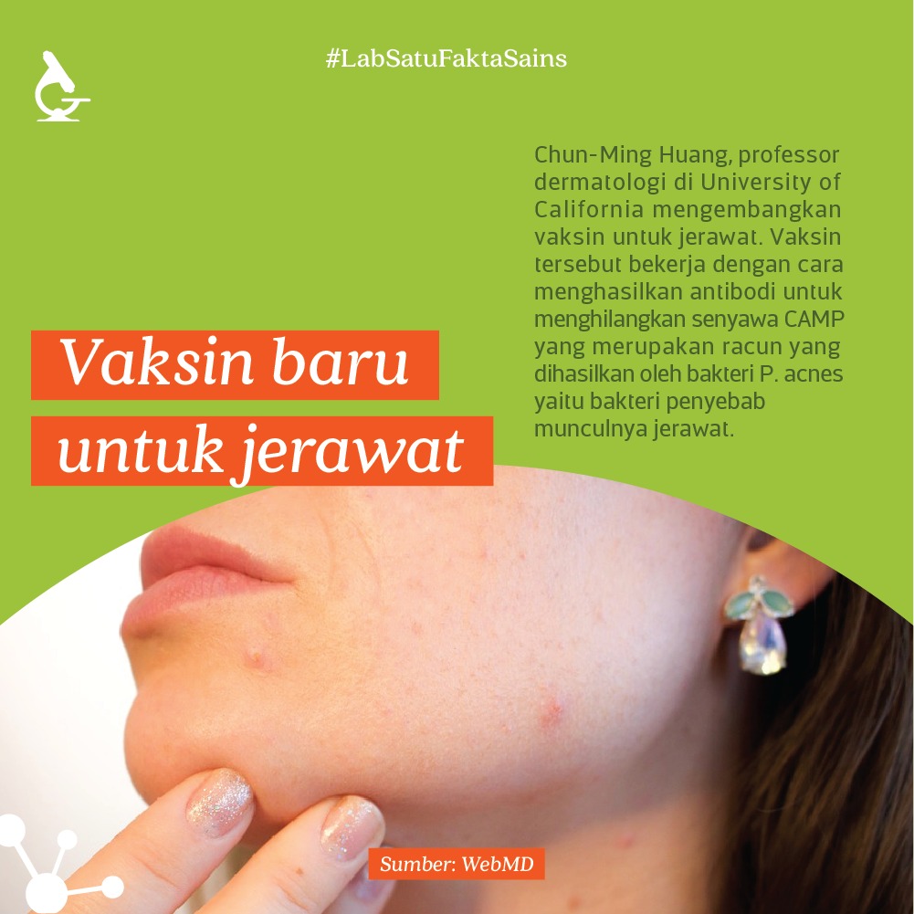 Vaksin Jerawat Kini Telah Ditemukan